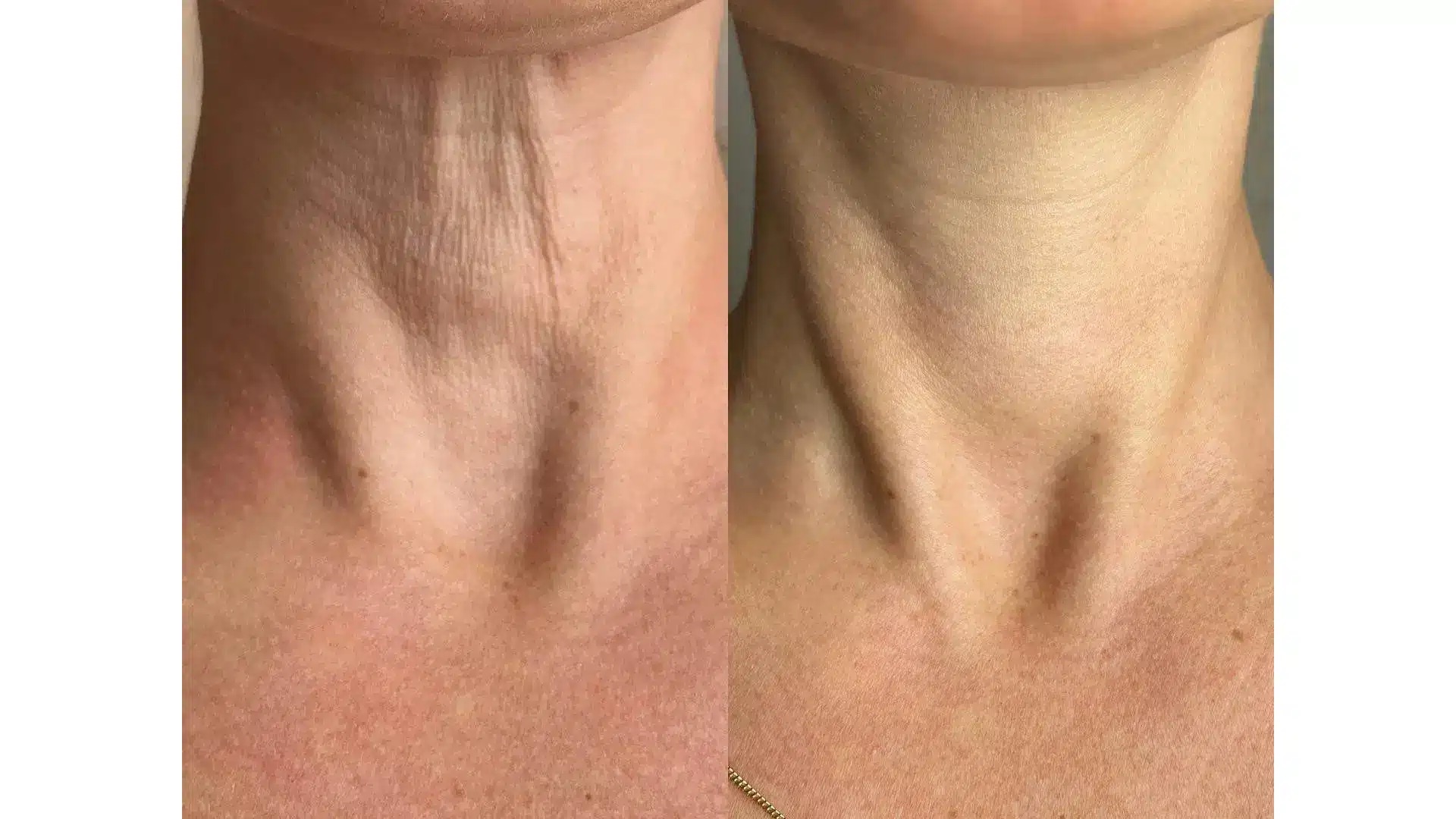 EJAL 40 előtte-utána 1