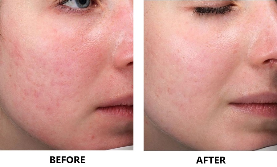 PolyPhil eredmény 2